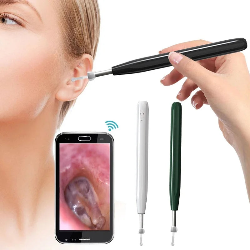 Dispozitiv Curatare Urechi cu Camera HD si Conexiune Telefon
